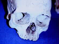 Scull Image